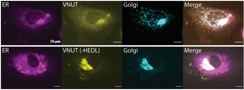 Damon_Poburko's tweet photo. If you are enjoying #SFN2021 and are interested in #purinergic signalling, check our poster tomorrow
P083.01. #SLC17A9 is likely a resident ER/Golgi protein rather than a #vesicular protein based on colocalization analyses and phylogenetic analysis of protein trafficking motifs https://t.co/421IbX6ffm