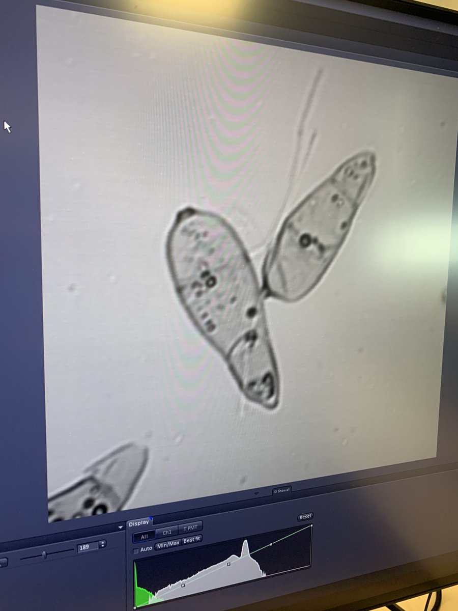 DannyScadding's tweet photo. A practical I did last Thursday (04/11/21) was about biological imaging we looked at Green Fluorescent proteins and spores! I had the chance to make my own spore slide as well as a chance to use a confocal microscope! https://t.co/BbqMPr4Lcd