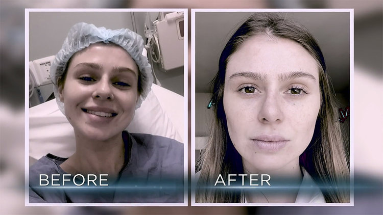 ThePenguinOffi1's tweet photo. I almost feel bad for reality TV stars who feel like they need to go under the knife. THERE WAS NOTHING WRONG WITH RAQUEL'S NOSE BEFORE!!! https://t.co/aUcDJwVs0Q