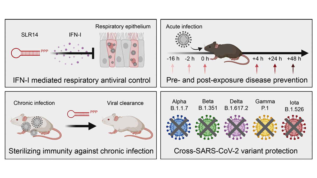 Journal of Experimental Medicine (@jexpmed) on Twitter photo This study by <a href="/tianyangmao/">Tianyang Mao</a> et al. @virusesimmunity team shows that RIG-I agonist stem loop RNA (SLR) triggers potent antiviral defense against #SARSCoV2 to prevent primary infection and clear chronic infection. bit.ly/3wwnlhP
#COVID19 #InfectiousDisease #HostDefense This study by <a href="/tianyangmao/">Tianyang Mao</a> et al. @virusesimmunity team shows that RIG-I agonist stem loop RNA (SLR) triggers potent antiviral defense against #SARSCoV2 to prevent primary infection and clear chronic infection. bit.ly/3wwnlhP
#COVID19 #InfectiousDisease #HostDefense