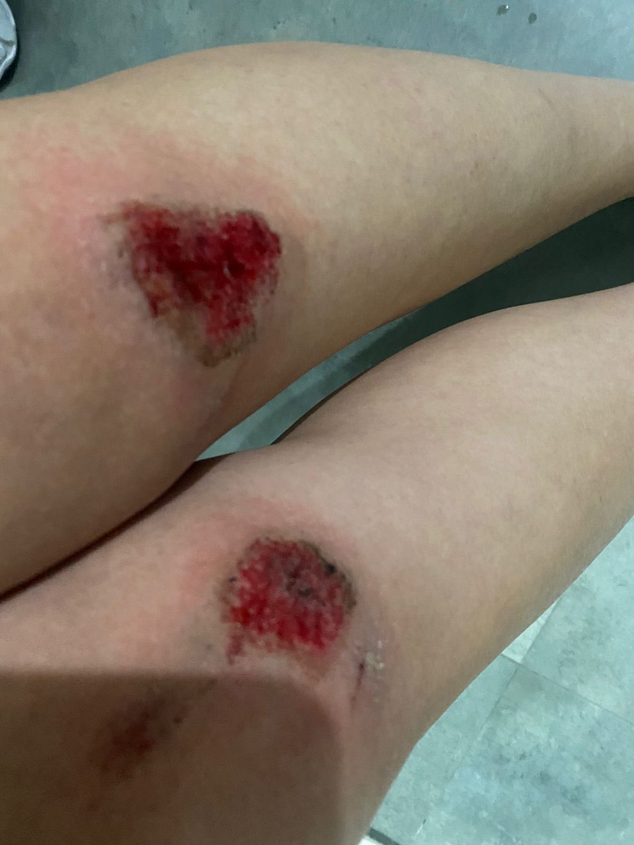 karla_noriega1's tweet photo. #Loja estos “pernos” son un peligro para los transeúntes (se evidencia en la segunda foto), los cuales quedaron expuestos luego de la “regeneración urbana”. Por favor atender a quien le corresponda @MunicipioDeLoja https://t.co/iFtpsBXgg3