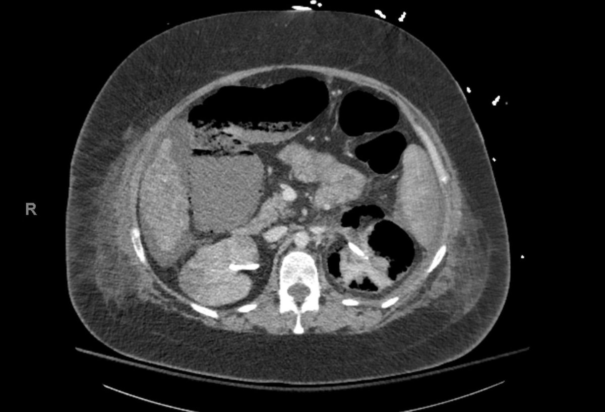 Urology Case Reports tweet media