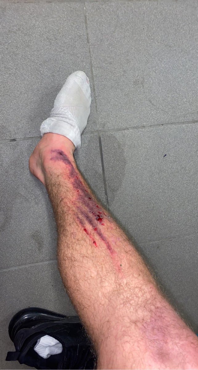 MartinsEnScred's tweet photo. Pas de match ce week end, donc petit amical contre notre équipe 3 (R3) à l’entraînement. 
Le résultat en 15mn : https://t.co/degVoJr3YK