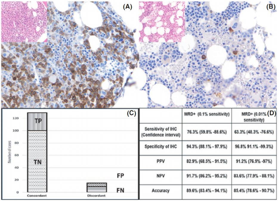 UTSW Department of Pathology (@utsw_pathology) on Twitter photo Congratulations, Dr. Olga Weinberg! <a href="/weinberg_olga/">Olga Weinberg, MD</a> Check out "Role of immunohistochemistry and flow cytometry in minimal residual disease detection in NPM1-mutated AML.
onlinelibrary.wiley.com/doi/10.1111/ij… Congratulations, Dr. Olga Weinberg! <a href="/weinberg_olga/">Olga Weinberg, MD</a> Check out "Role of immunohistochemistry and flow cytometry in minimal residual disease detection in NPM1-mutated AML.
onlinelibrary.wiley.com/doi/10.1111/ij…