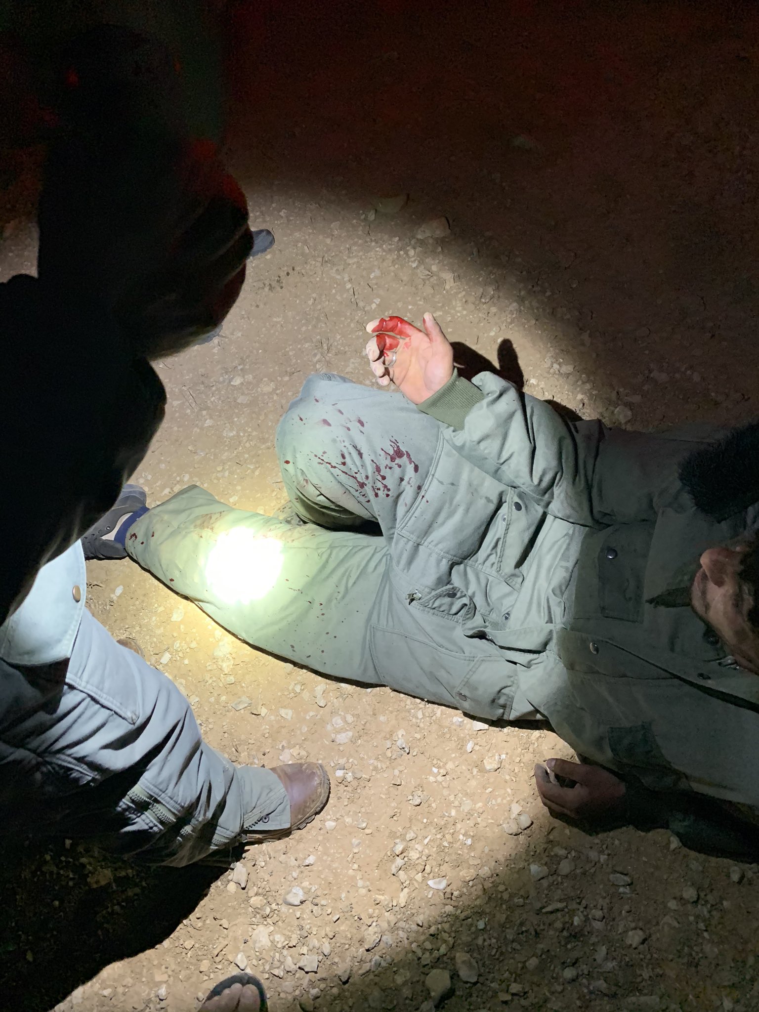 Injury to hand sustained by Arab during altercation near Mitzpe Yair.