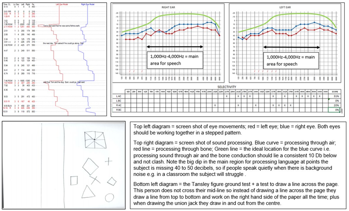 CharlotteEDavie's tweet photo. Maths anxiety looks like this... it is not a mystery it requires good support for holistic child development to sort it out. Let's make all our children fit 2 learn. https://t.co/vBQBniFGKX