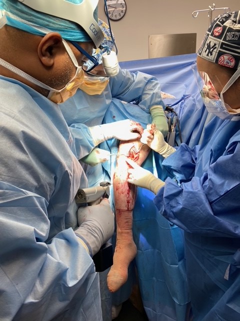 MaxxOrthopedics's tweet photo. Proud that Freedomยฎ Renew Knee was selected by Dr. Henderson for the first joint arthroplasty procedure performed at Meta Surgical Center. Visit our booth #345 at #aahks2021 to learn more. #perfectcase #renewknee #orthopedics #kneearthroplasty #maxxortho #ASC #outpatient https://t.co/9kP2sIFzjg