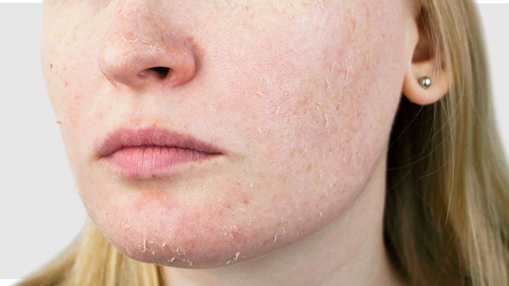 preetyface_co's tweet photo. Siapa kat sini ada masalah kulit kering / Dehydrated skin? https://t.co/2JcFBUuO8P