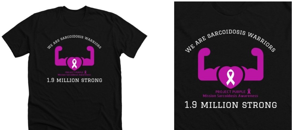We are warriors!
CLICK THE LINK TO ORDER YOURS🔽
bonfire.com/sarcoidosis/

#sarcoidosis #documentary #awareness #disease #warrior #findacure #sarcoidstories #advocate #advocacy #sarcoidosisnews #fundraising #tshirts