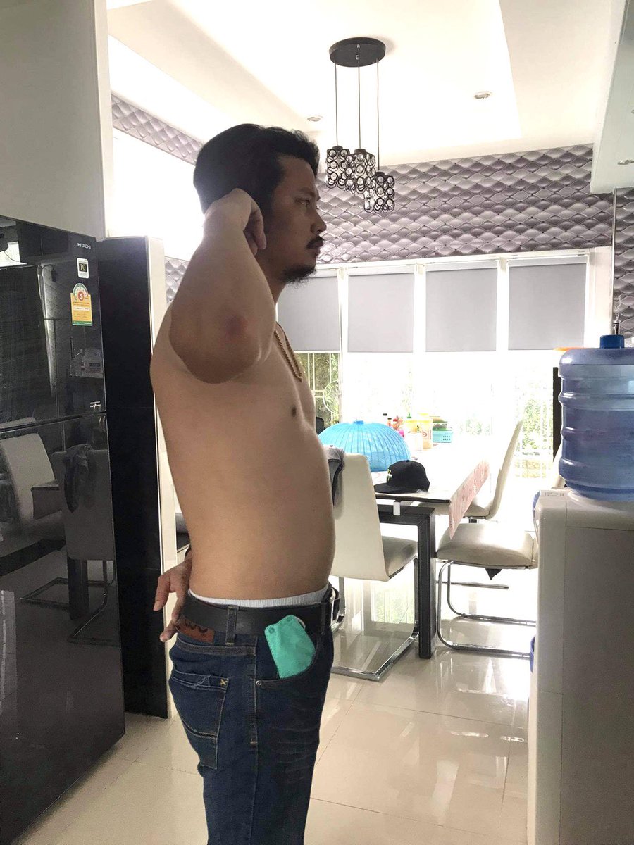 nbna602's tweet photo. เวลาออกไปเจอเพื่อน เพื่อนแฟนทักทุกคน ⁉️ 
ว่าทำไมดูแก่ขึ้นจังว่ะ ตัวหนากว่าเมื่อก่อนอีก นางก็เริ่มรู้สึกสีหน้าออกละว่าเราเริ่มเครียดละมีคนทักบ่อยช่วงนี้เราต้องทำอะไรสักอย่างเลยได้สูตรมาให้นางทำ พอนางเริ่มทำได้ 1 เดือน เห้ย มันเริ่มลีนกว่าเดิมเยอะมาก สัดส่วนเริ่มเห็นได้ชัดกว่าเดิม https://t.co/VB24nR0klq