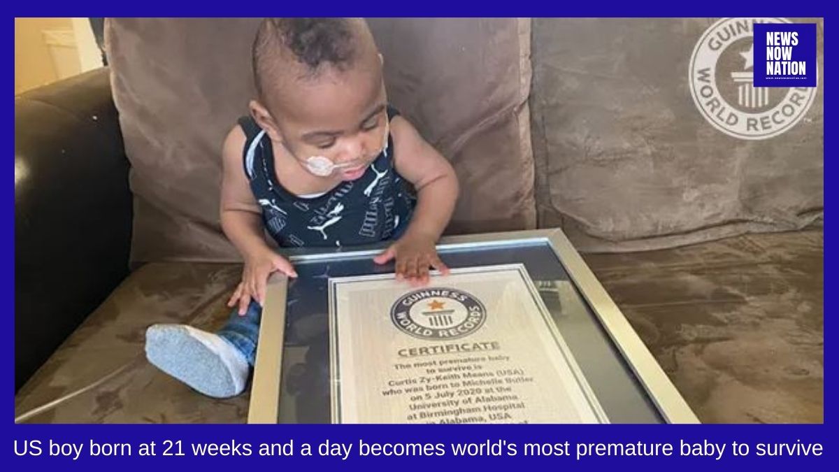 NewsNowNation's tweet photo. US boy born at 21 weeks and a day becomes world's most premature baby to survive
#GuinnessWorldRecords #prematurebaby #Curtis #hospital #USboy https://t.co/LRBdIp5QhE