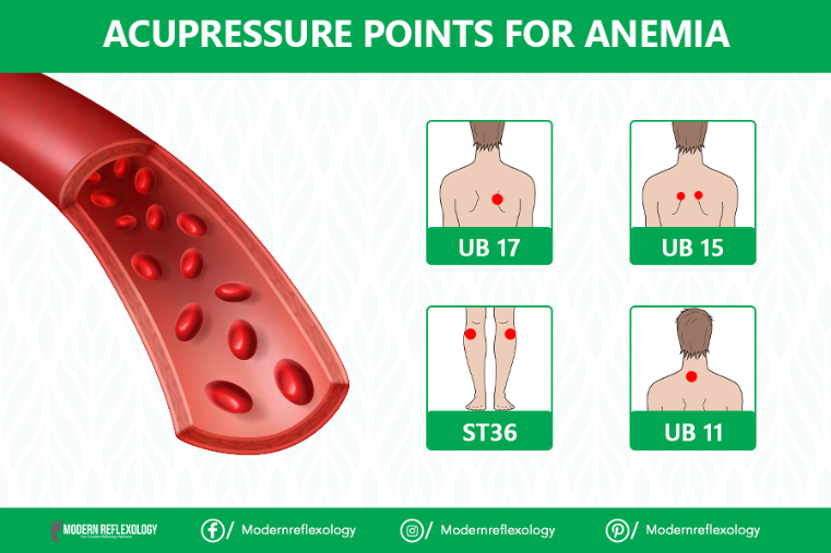 modreflexology's tweet photo. Press these points ST36,UB11 and 2 more for one minute as you breathe deeply can increase Red blood cells in blood.

#Modernreflexology #Reflexology #RBC #Anaemia #increasebloodcells #bloodcell #ST36 #UB11 #selfcare #selfhealling #health https://t.co/JadZUYAGHf