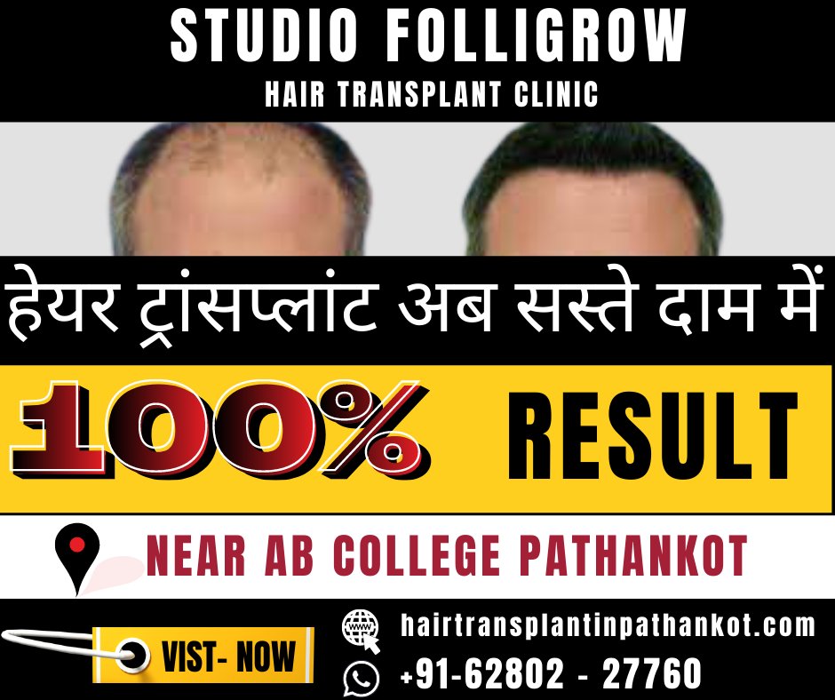 studiofolligrow's tweet photo. #STUDIO #FOLLIGROW #PATHANKOT #PUNJAB.
☎ ☎ -: 94177-27239, 62802-27762
visit: https://t.co/fXJiEcnjVK https://t.co/rM6xNFTncn