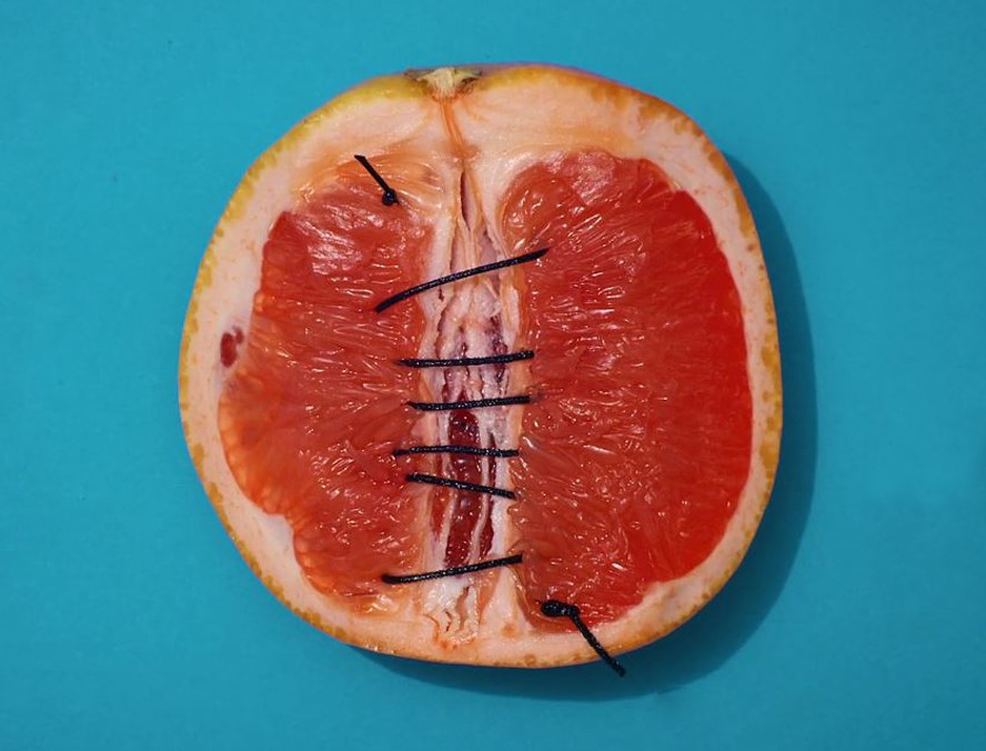 Das Bild „#TheOtherVulva - Gemeinsam gegen weibliche Genitalverstümmelung” von @PlanGermany landet in der Kategorie Storys &amp; Kampagnen auf Platz 1 und ist gleichzeitig PR-Bild des Jahres Deutschland! Ein wirklich starkes Bild! #prba21