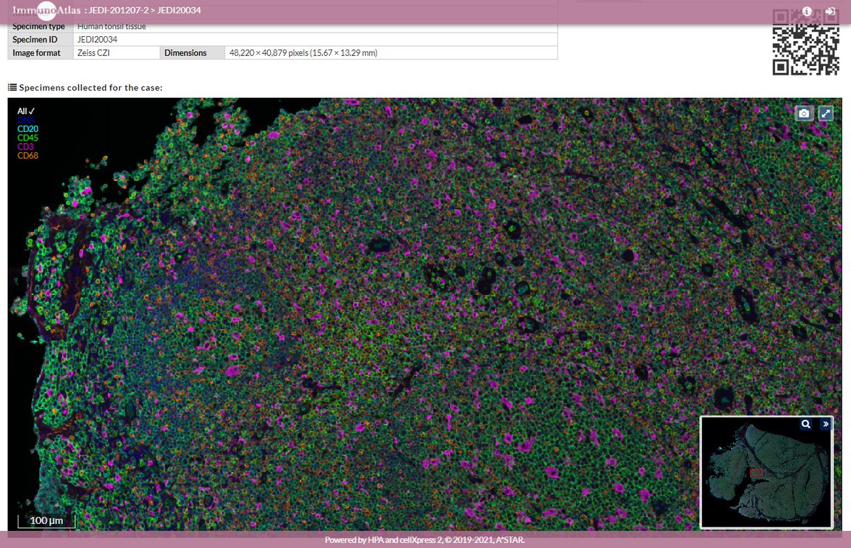 immunoatlas's tweet photo. 📢We're excited to finally be on Twitter. Check out our cloud-based platform for sharing and visualizing raw #multiplexIHC tissue images and results for #immunooncology!

Find out more: https://t.co/B1z7vyV9q7

@LitHsinLoo @JoeYeong @joeyleejiaying https://t.co/DGUUY4D5cy