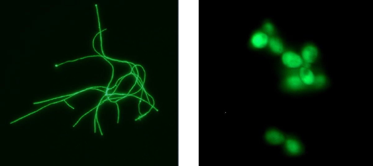 MRCcmm's tweet photo. #Mycotalks this Thursday:
@dwdenning: "Why are there still so many deaths from #FungalDisease?"
and
Anita Sil: "Regulation of cell shape & #virulence in thermally #dimorphic #FungalPathogens"
Chairs @DrAlexBrand & @judithberman11
https://t.co/TZasr508Uz https://t.co/68O8Fsn3tt