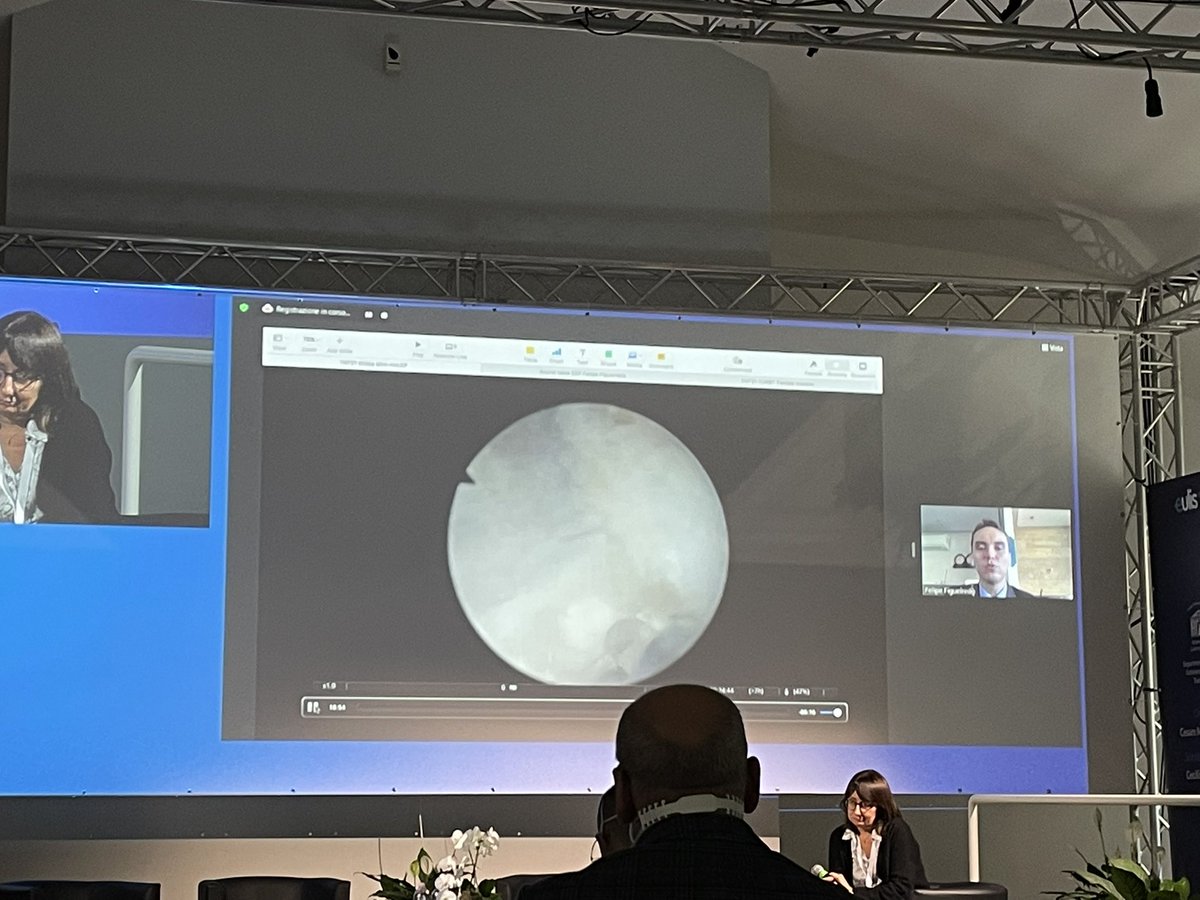Zoltán Kiss (@zoltankissdr) on Twitter photo Great semi-live mini-HolEP from <a href="/FCAFigueiredo/">Felipe Figueiredo HoLEP 🇧🇷</a> at #TnT2021. Excellent sphincter preservation! <a href="/kpetik1/">Peter Kovacs, MD, FEBU</a> Great semi-live mini-HolEP from <a href="/FCAFigueiredo/">Felipe Figueiredo HoLEP 🇧🇷</a> at #TnT2021. Excellent sphincter preservation! <a href="/kpetik1/">Peter Kovacs, MD, FEBU</a>