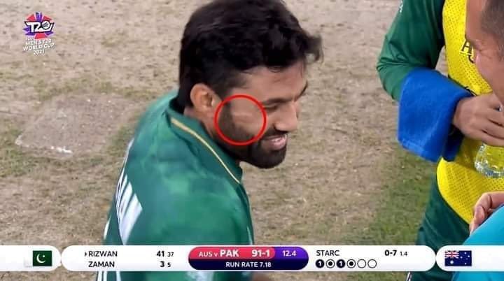 umarsaif's tweet photo. For me, Rizwan defined the spirit of Pakistan Cricket. 

He was in ICU for 2 days but played today; hit on the face with a bouncer but went on to be the top scorer; kept the wickets with a vicious bruise on the face. 

You showed the world why they can’t ignore Pakistan cricket! https://t.co/CMSbWPQBzl