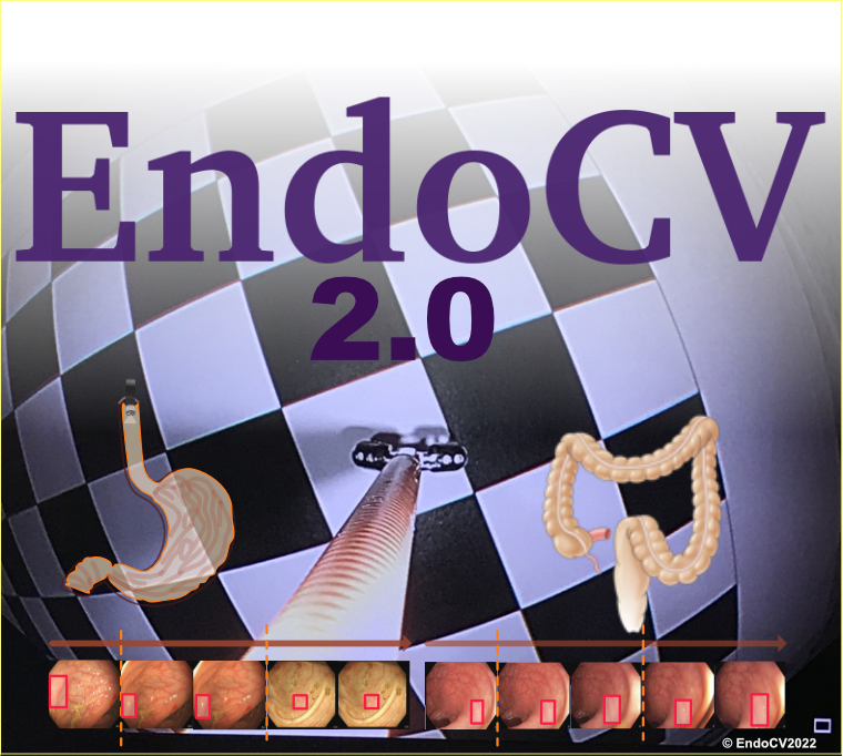 cv_endo's tweet photo. Endoscopic computer vision challenge 2.0 (#EndoCV 2022) goes online...
- Targeted towards endoscopic video sequence
- Develop novel methods in endoscopy (elimination rounds to guarantee this!)
Join us and spread the news.
https://t.co/8xI6prW1bB
#endoscopy #polyps #artefact #AI https://t.co/CJavZAo3rK