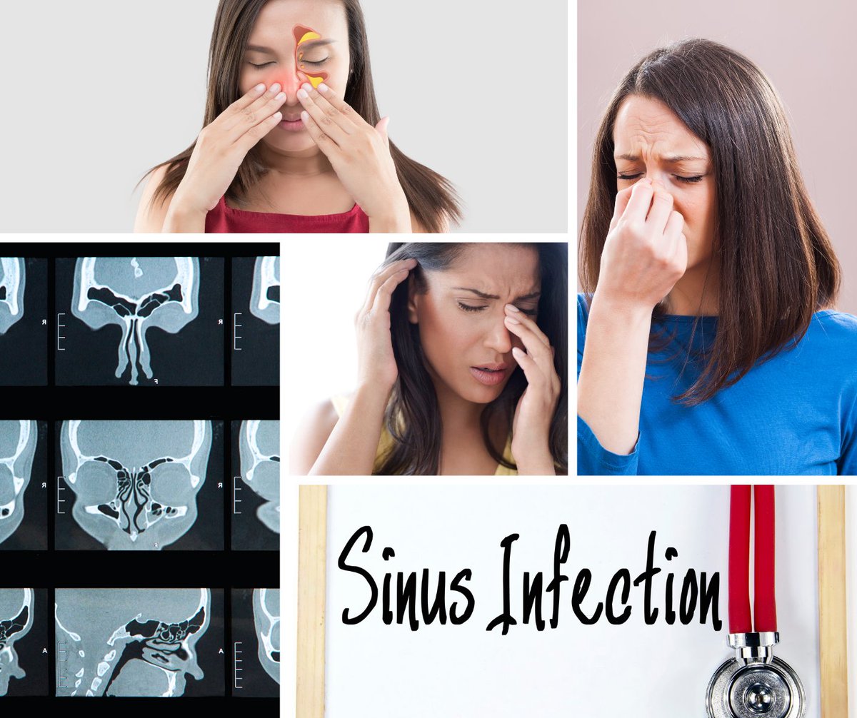 Secondmedic's tweet photo. I just published Sinus: causes and cure. https://t.co/s6ypIPBtFS https://t.co/X9yaNx7l0J