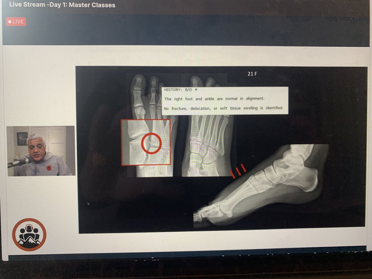EMCases's tweet photo. .@arunsayal1 is delivering his masterclass on “when x-rays lie” at #EMCSum21. World class speaker and a wonderful mentor to so many of us! First time I’ve heard Baysian theory incorporated so beautifully into an ortho talk!  @MRamzyDO https://t.co/CAtypoFWCP