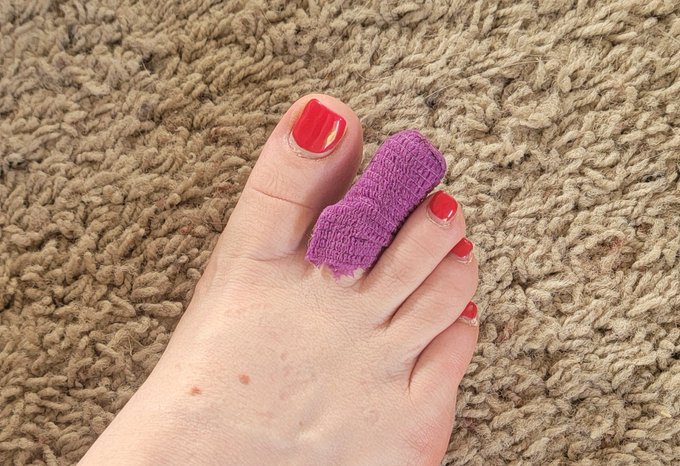 Toe update: I think the ripped up nail re adhered... https://t.co/Fu50wBYR9H<a href="/tag/femdom"class="tags"><span>#femdom</span></a><a href="/tag/chastity"class="tags"><span>#chastity</span></a><a href="/tag/keyholder"class="tags"><span>#keyholder</span></a><a href="/tag/lockedcock"class="tags"><span>#lockedcock</span></a><a href="/tag/chastitykeyholder"class="tags"><span>#chastitykeyholder</span></a>