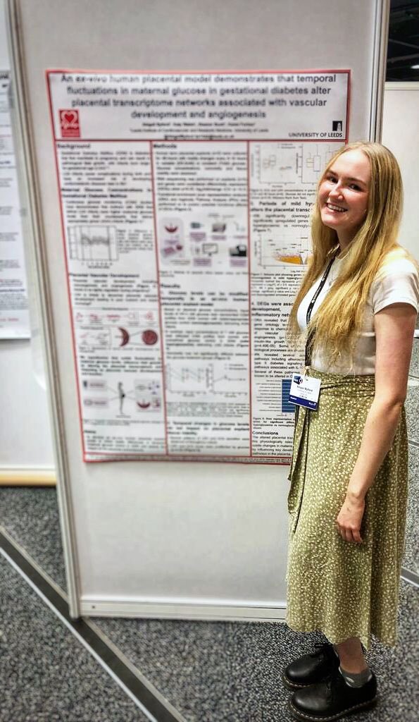 Karen Forbes (@drkarenforbes) on Twitter photo Had such a great time <a href="/Soc_Endo/">Society for Endo</a> #SfEBES2021. Edinburgh was as lovely as ever and itβs was so good to catch up with everyone in person again!
Super proud of <a href="/r_quilang/">π»π£ βπππππ βπ¦πππππ</a> <a href="/MargeuriteGina/">Dr Maggie Kennedy</a> <a href="/AbigailByford/">Dr Abigail Byford</a> for showcasing some of our <a href="/UoL_LICAMM/">LICAMM</a> #diabetes in pregnancy work so well! Had such a great time <a href="/Soc_Endo/">Society for Endo</a> #SfEBES2021. Edinburgh was as lovely as ever and itβs was so good to catch up with everyone in person again!
Super proud of <a href="/r_quilang/">π»π£ βπππππ βπ¦πππππ</a> <a href="/MargeuriteGina/">Dr Maggie Kennedy</a> <a href="/AbigailByford/">Dr Abigail Byford</a> for showcasing some of our <a href="/UoL_LICAMM/">LICAMM</a> #diabetes in pregnancy work so well!