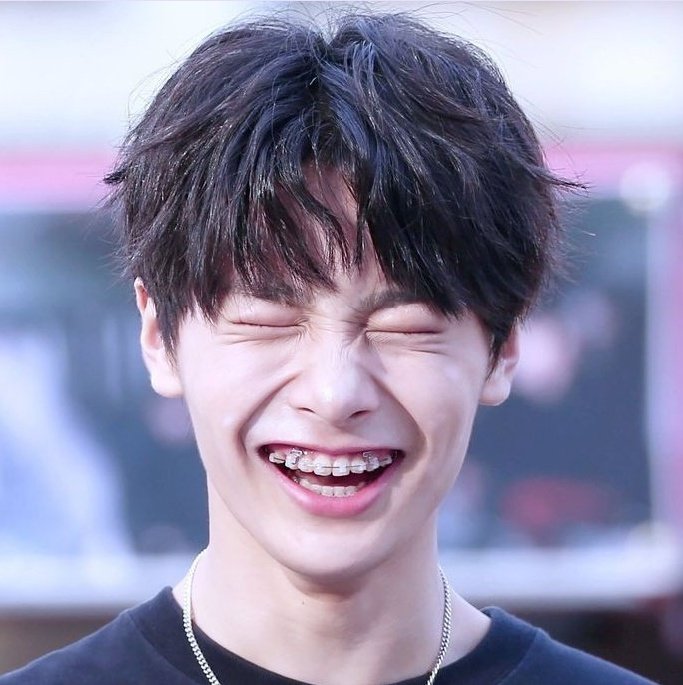 StrayKidsBrasil's tweet image. Usando a desculpa das tags de votação para colocar o I.N de aparelho na tml de vocês 🥺
#MAMAVOTE #straykids @Stray_Kids