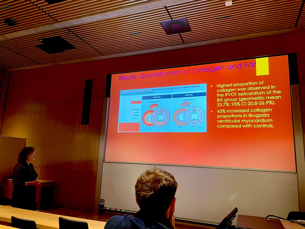 RodrigueGarcia4's tweet photo. #SuddenCardiacDeath Honorary Symposium for Professor Mary Sheppard at #Panum Copenhagen.
Thank you for this great lecture 🙏 @JacobTfelt @bowinkel75 @ThomasJesperse6 @nkstampe @jespersv4ne @CarlJohannH @PriyaPBK @cherian_lijo @arnelasaljic https://t.co/VlZXQYDfEp