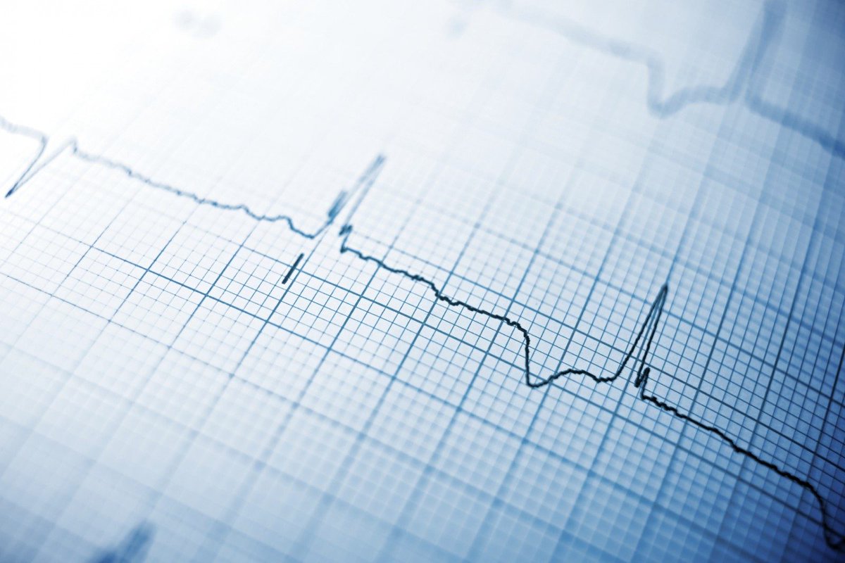 📣Cardiologists Assemble! 

The next instalment of the Hot Topics for Acute Physicians webinar series from the Institute of Medicine is an unmissable event for anyone interested in Cardiology. Places are filling up fast!

Find out more or register now ⬇️
courses.rcpi.ie/product?catalo…
