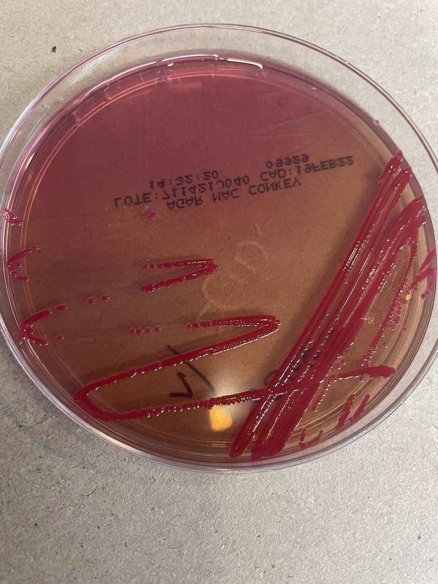 carla89rom's tweet photo. Serratia marcescens is a facultatively anaerobic bacterium, gram negative rod with could be red in agar for the pigment prodigiosin.
Can cause a nosocomial or community abdominal,lung or urinary diseases
#bacter #lovemicrobiology #idlive https://t.co/wboryN3vze
