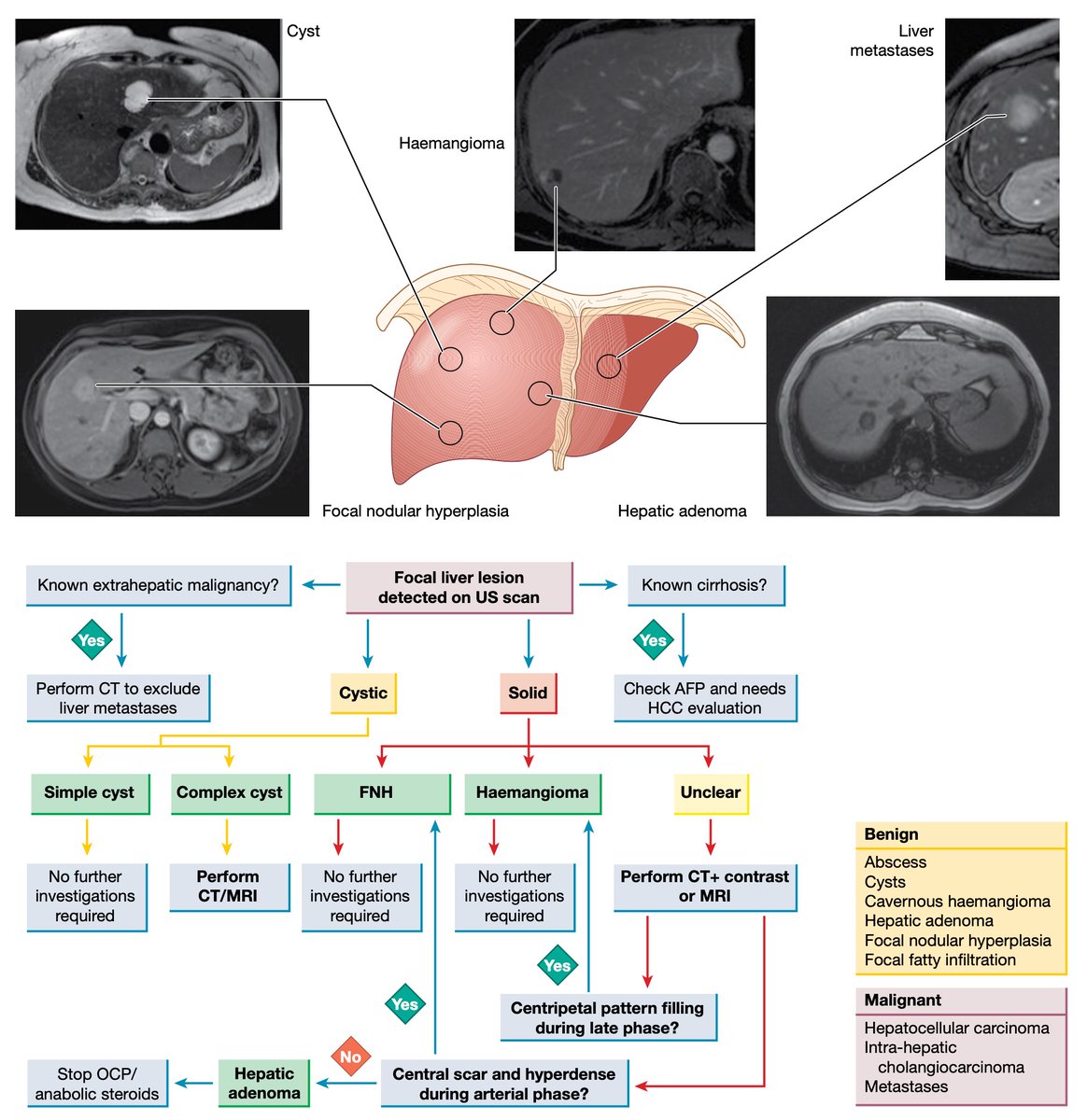 drkeithsiau's tweet photo. Approach to focal liver lesions #4KMedEd #LiverTwitter

(via Hepatology at a glance) https://t.co/941uI4ZCJ8