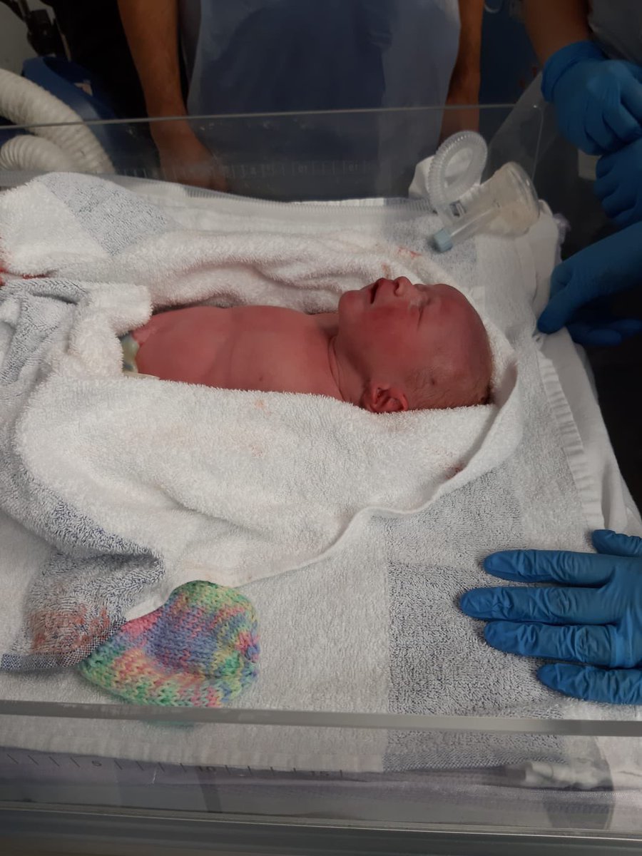 DanniRowson's tweet image. After a scary emergency C-Section our little boy was born at 1:29pm TODAY weighing 5lbs 13oz 6 weeks early!! I was VERY poorly but feeling better ❤️ #newborn #ileostomy @ColostomyUK @Coloplast_UK @MeetAnOstoMate @iasupport
