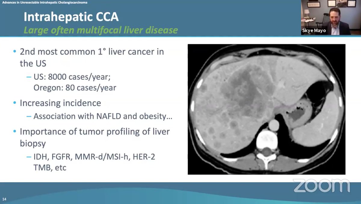 curecc's tweet photo. Intrahepatic cholangiocarcinoma (ICC) is the 2nd most common 1° liver cancer in the US. ICC has several important mutations to look at. @drymtn https://t.co/Z447NMG0JE