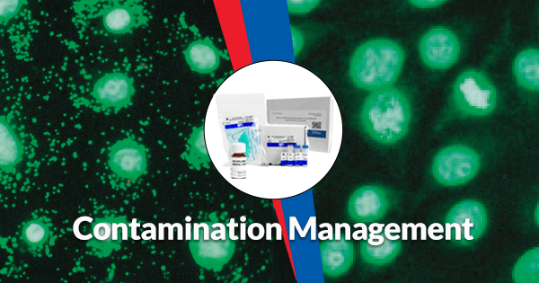 mpbiomedicals's tweet photo. Do you need a solution for managing mycoplasma contamination in your valuable cell cultures? Try MP Bio's kits and reagents for prevention, rapid detection, sensitive detection and effective removal of mycoplasma. Learn more here: https://t.co/P2cWdp59Z3 https://t.co/IxnNKZVDRS