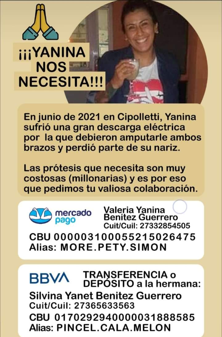 Disculpen que moleste con esto pero solo necesitamos que 6000 personas donen nada más que $100 para que Yanina de Cipolletti pueda tener su protesis de nariz antes de fin de año.