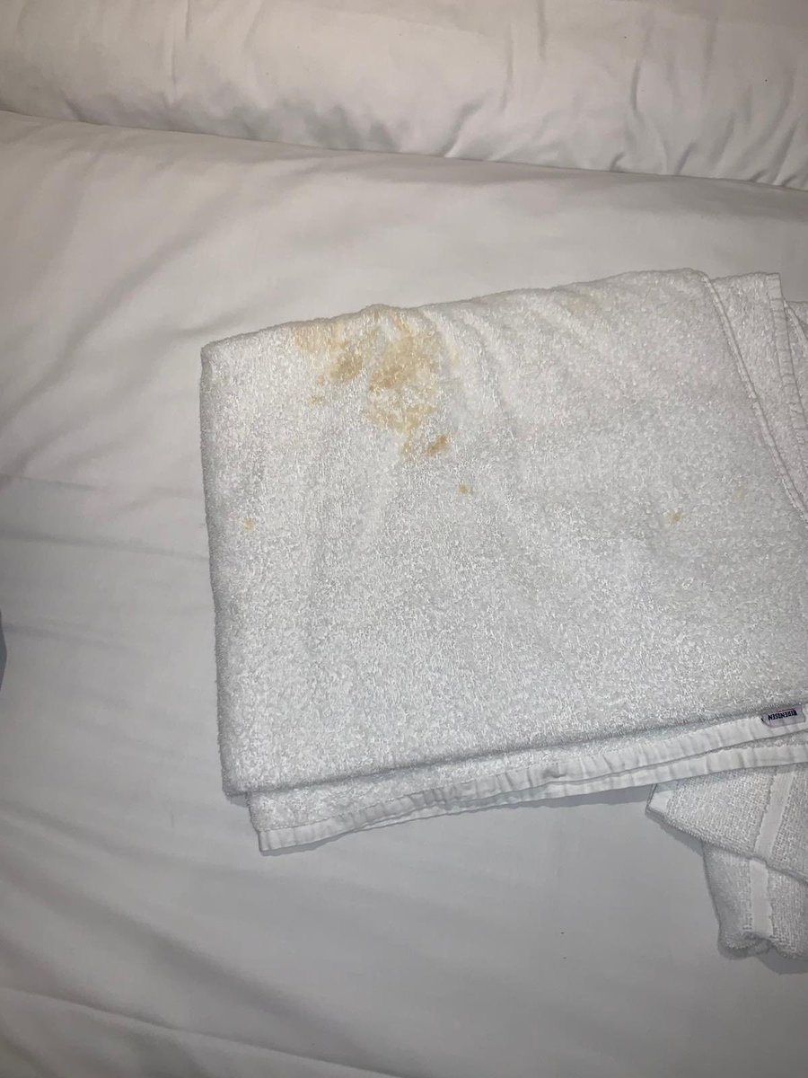 BeckyA83's tweet photo. @TravelodgeUK just checked into your Gatwick location - super room - and was confronted with this on my bed - not really super is it…..this was the towel left on my bed. https://t.co/ydSXURwbZT