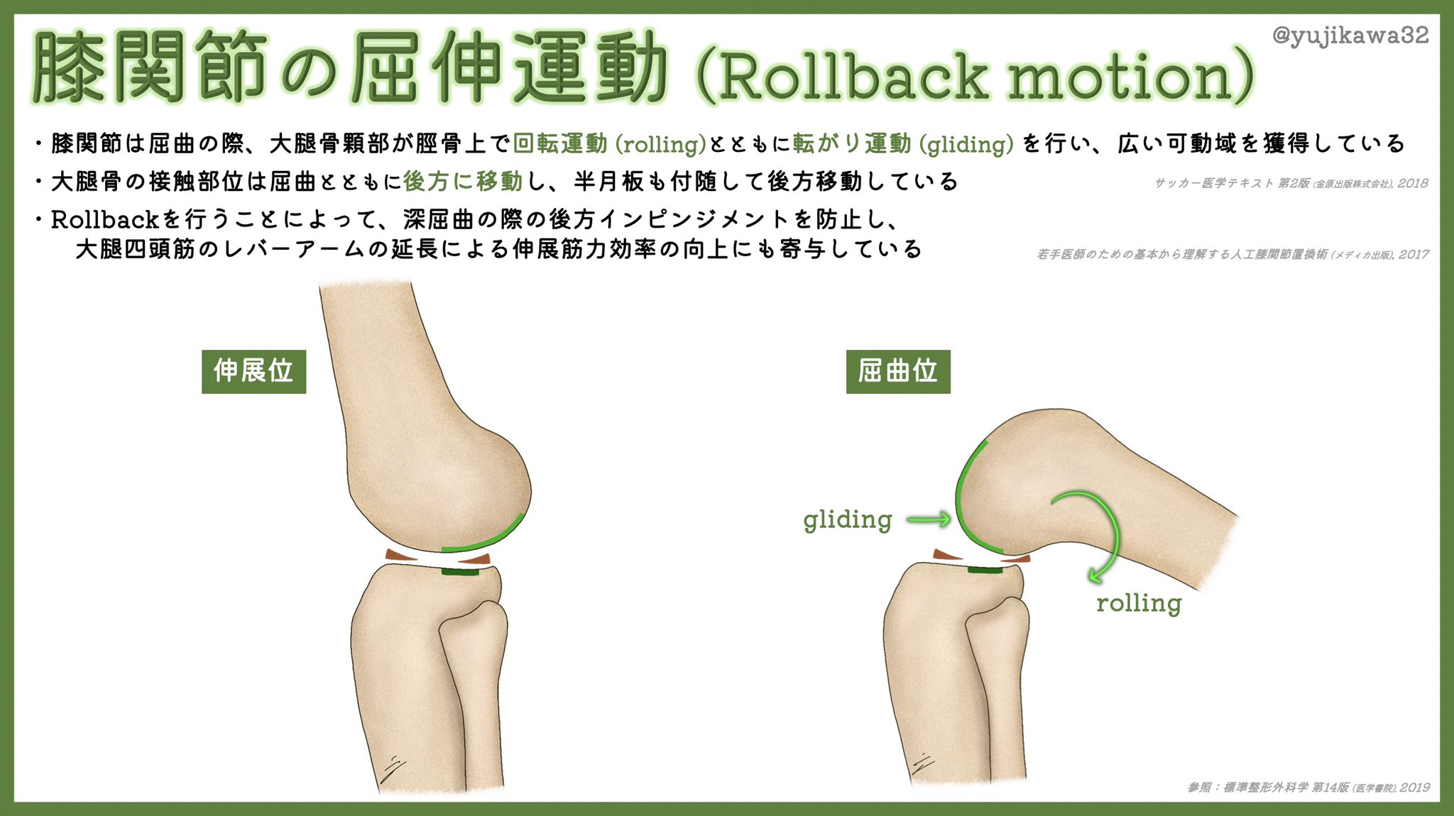 ユジカワ 整形dr イラストレーター 膝関節が曲がるときには 大腿骨は回転運動だけじゃなく後ろへの転がり運動もしている 身体的には無意識に行なっているので なんでも効率良くできているところに人体の不思議を感じる 膝関節 屈伸運動 Rollback