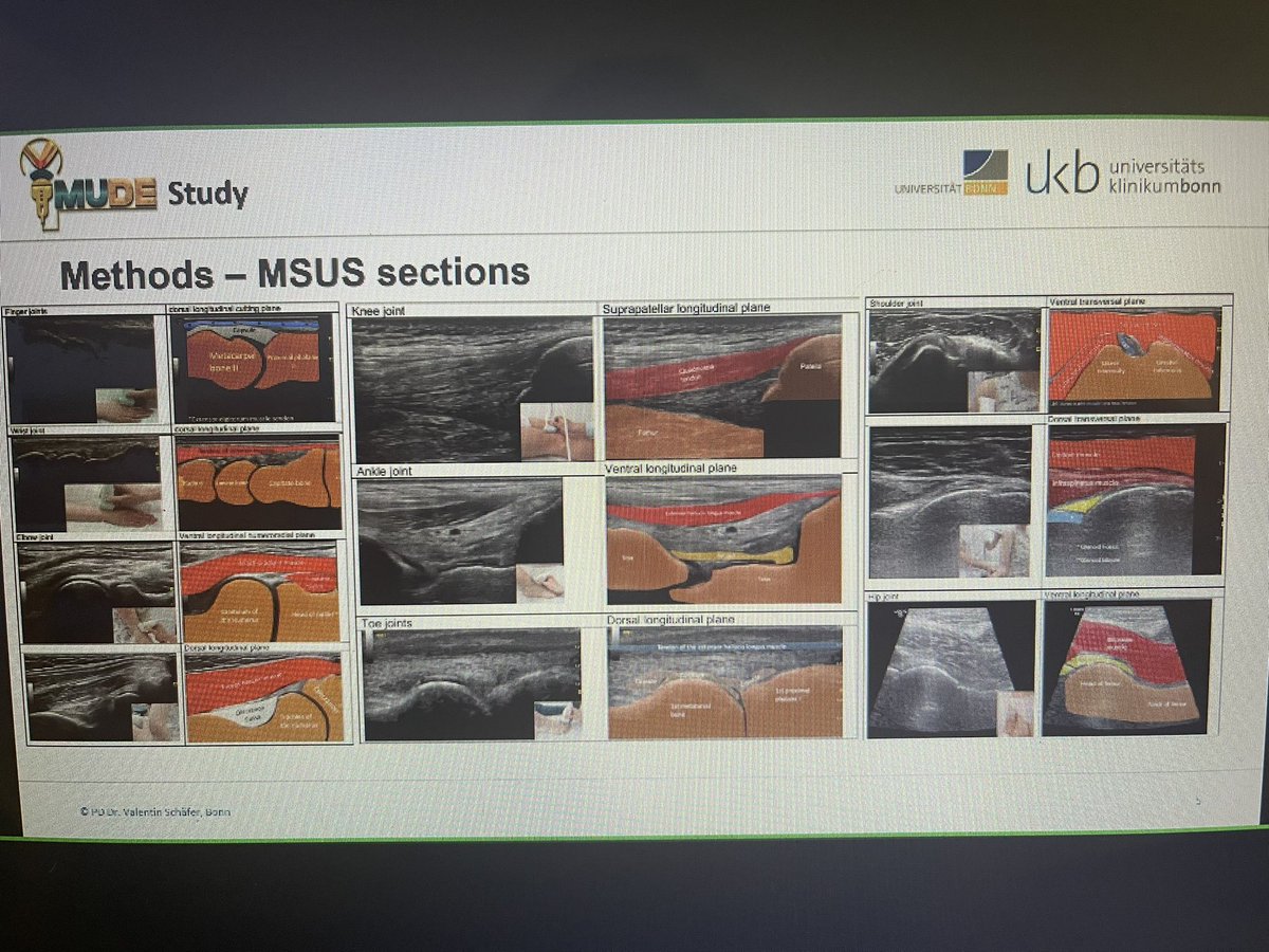 zineb1010's tweet photo. Thank you for sharing your ideas and experiences teaching MSK US for non-rheumatology practitioners!
#ACR21 #ussonar_Rh https://t.co/5pgh26DCnd
