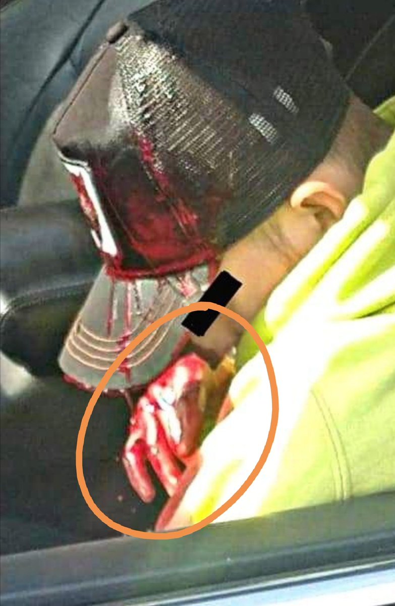 Daiskesu's tweet photo. La muerte Octavio necesita justicia, en la escena al menos 15 policías preocupados por revisar dentro de la camioneta &amp; tomando fotos, dentro del auto el que requería ayuda en medio de la agonía. 
&amp; Encima de todo Alfredo sacando cara por estos pndjos.

 #JusticiaParaBenito https://t.co/WreS9nkkSn