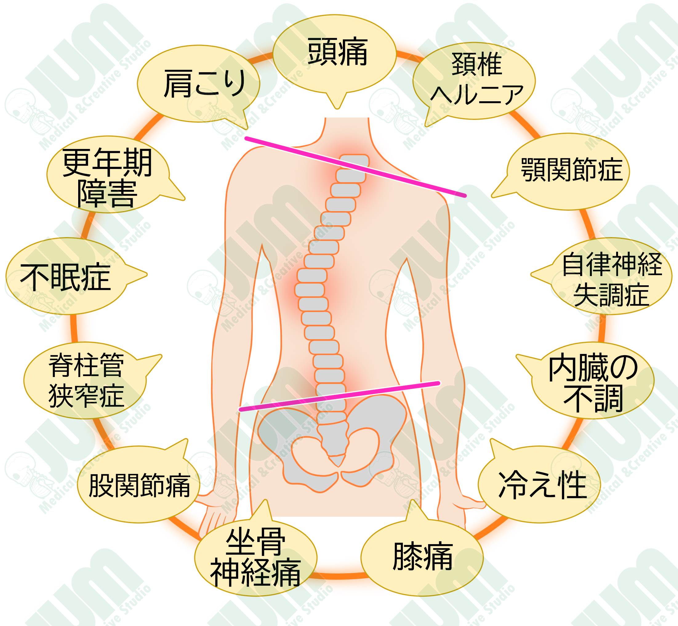 じゅんペい 制作物紹介 脊柱の歪みと諸症状 柔道整復師 イラストレーター 医療 医療イラスト イラスト Illustlation Illust Medical 有償依頼 依頼受付中 ココナラ Coconala 脊柱 姿勢の歪み T Co Xgbrroxgyz Twitter