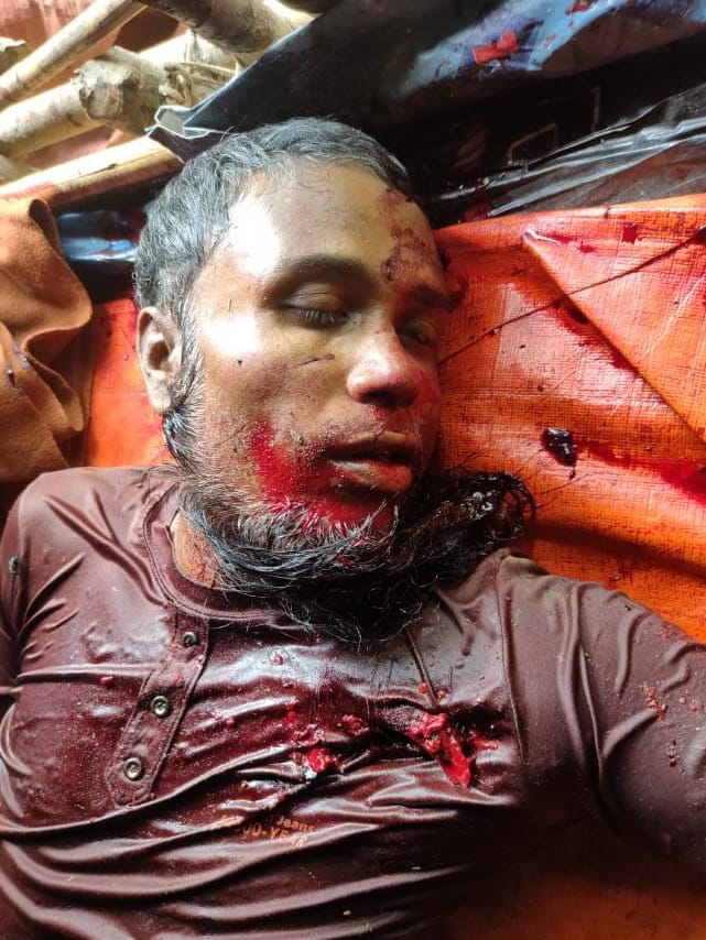 Abdulla_AH7's tweet photo. Graphic Warning ‼

Five #Rohingya people were killed brutally by the terrorist #Military today in Maungdaw, Chinkali. 

#RohingyaLives #Stopkilling #EndViolence #SaveRohingya #SaveMyanmarPeople https://t.co/dqTVXBUOOF