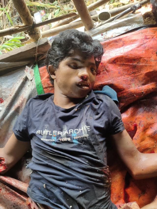 Abdulla_AH7's tweet photo. Graphic Warning ‼

Five #Rohingya people were killed brutally by the terrorist #Military today in Maungdaw, Chinkali. 

#RohingyaLives #Stopkilling #EndViolence #SaveRohingya #SaveMyanmarPeople https://t.co/dqTVXBUOOF