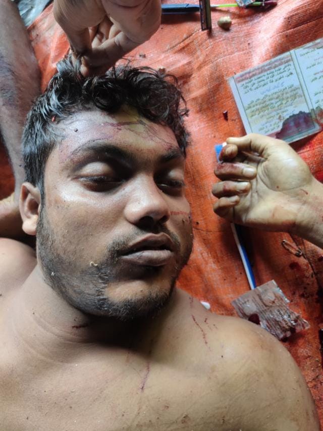 Abdulla_AH7's tweet photo. Graphic Warning ‼

Five #Rohingya people were killed brutally by the terrorist #Military today in Maungdaw, Chinkali. 

#RohingyaLives #Stopkilling #EndViolence #SaveRohingya #SaveMyanmarPeople https://t.co/dqTVXBUOOF