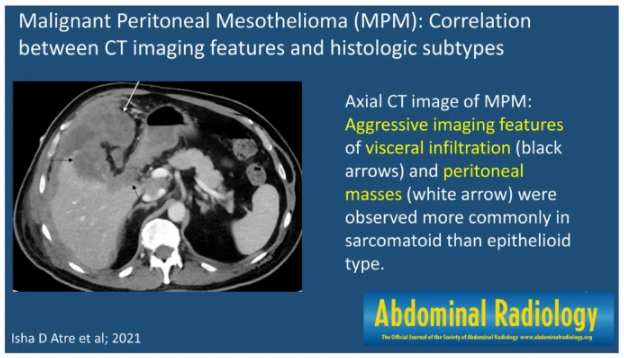 Abdominal Radiology tweet media