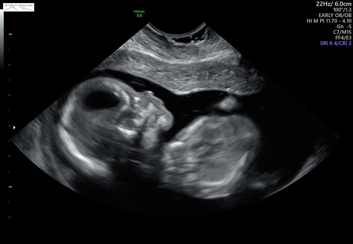 Raleigh Anne Gray tweet media