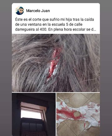 Yanelit09's tweet photo. @fsusbielles Que hicieron los años anteriores? UNA VENTANA SE LE CAYO EN LA CABEZA. No un vidrio. UNA VENTANA COMPLETA. No tiene cara la provincia en decir que están invirtiendo. No voy a parar hasta que esté resuelto EL ULTIMO PROBLEMA DE LA ESCUELA 5. https://t.co/YHySweOkhI