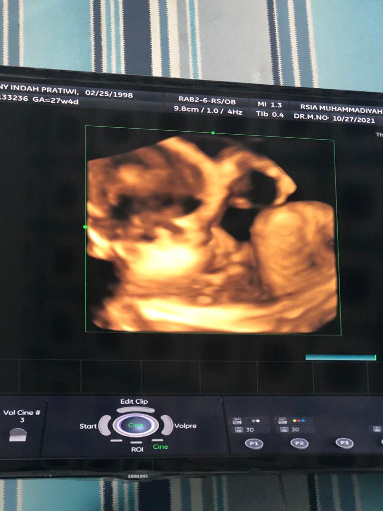 Sehat2 gantengku ❤💞