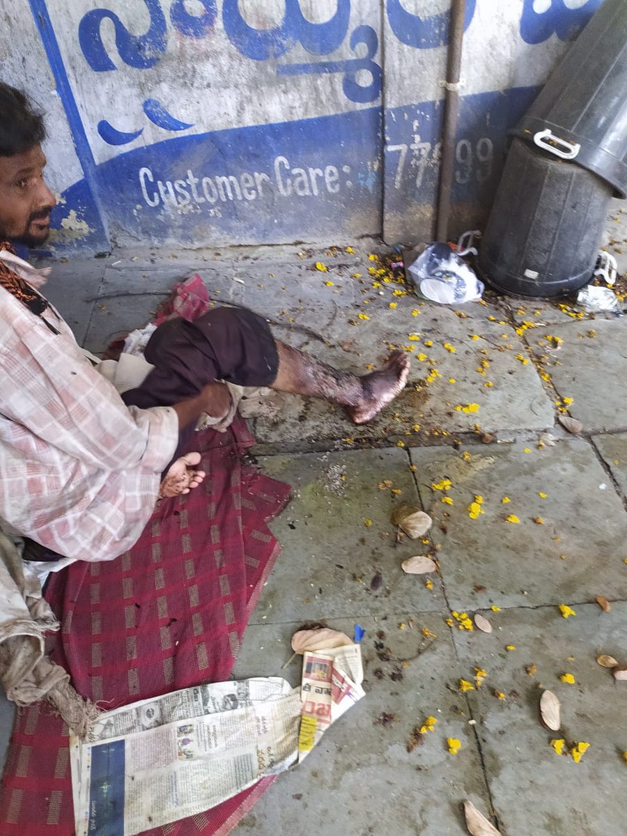 GoodSamaritanIn's tweet photo. This homeless man was rescued with wound filled maggots, we took him to hospital for his treatment. He is doing better now and is residing at our home care center. If you want to lend a helping hand for the work we do, we request you to donate.
https://t.co/CaKxrU1Zos
#donatenow https://t.co/MhqtEa1RJg