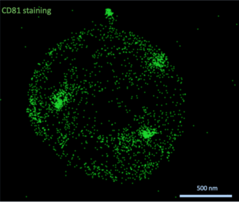 Why leave the best MSC-EV super resolution image in the Supplementary? Because we want you to read it all! 😉mdpi.com/1336022 #mdpicells #EVItaSociety #mesenchymal stromal cells #IsevConnect #Nanoimager #microscopy